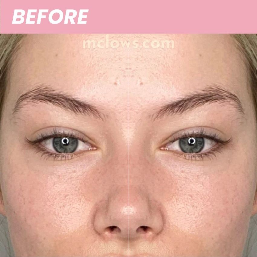 LashLift™️ Electric Lash Curler