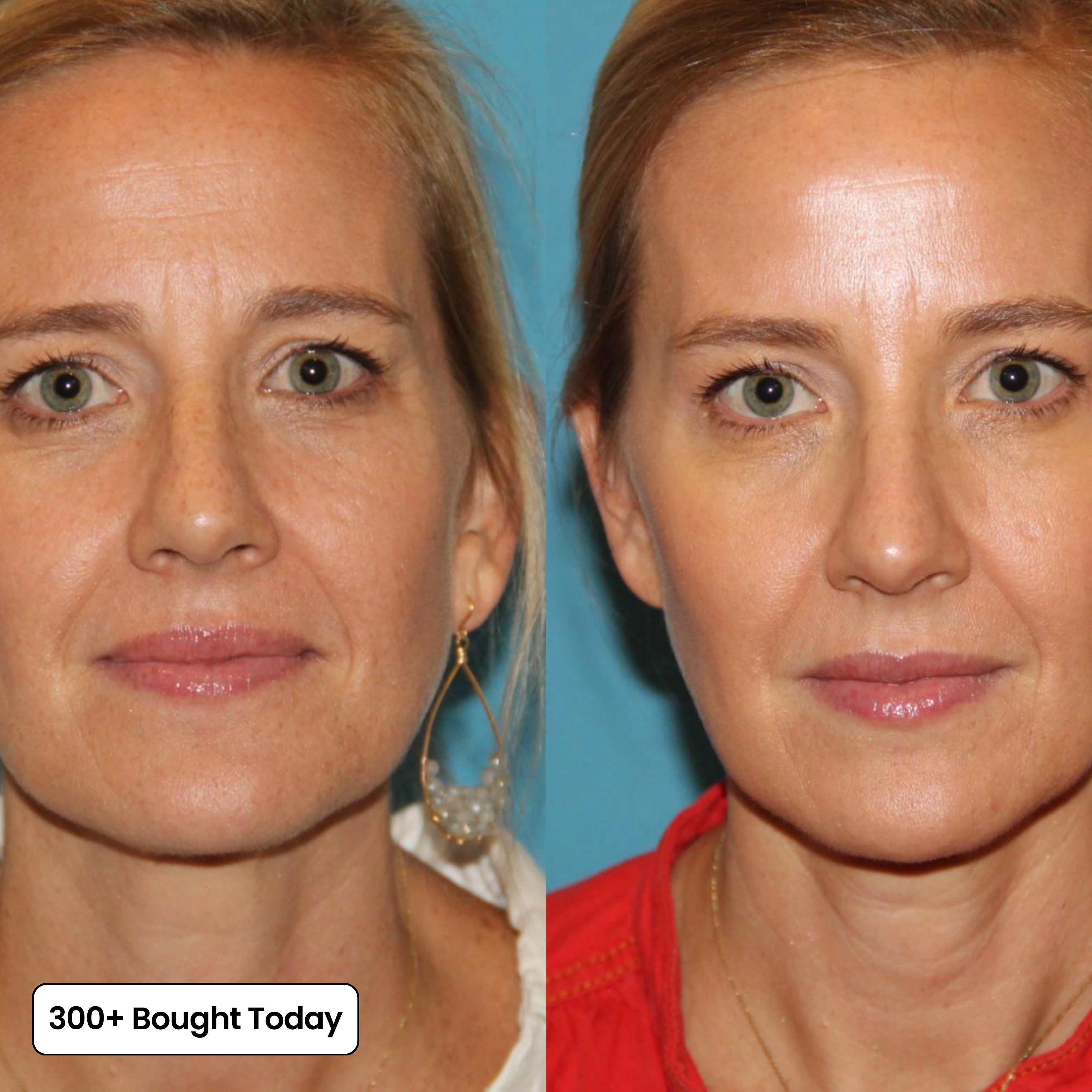 Skin Revival™ Honey Balm