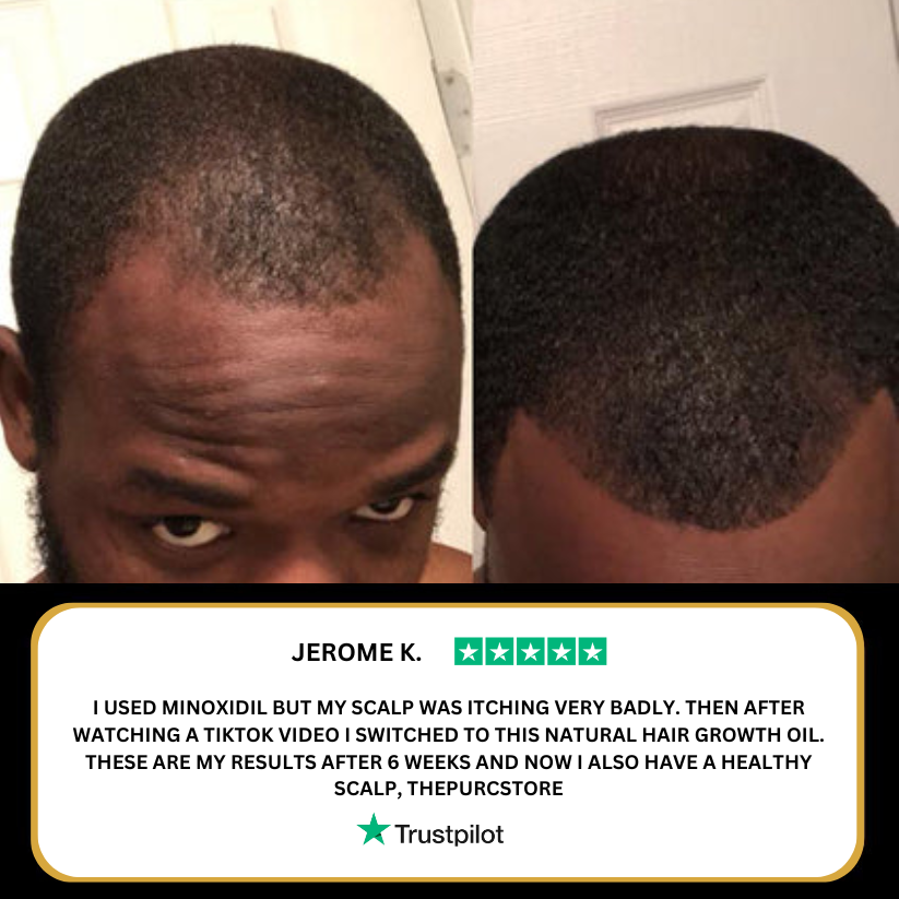 PURE™ Natural Hair Growth Oil