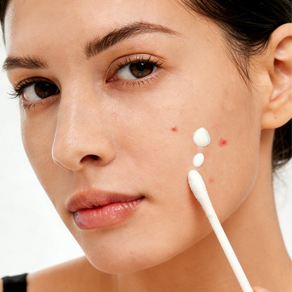 The Acne Buster™ Drying Lotion Plus (1.8% Encapsulat