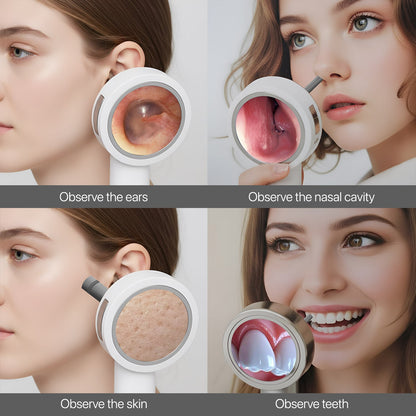 OTIVIEW PRO | Digital Otoscope Smart Ear Inspection