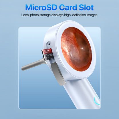 OTIVIEW PRO | Digital Otoscope Smart Ear Inspection