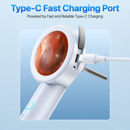 OTIVIEW PRO | Digital Otoscope Smart Ear Inspection