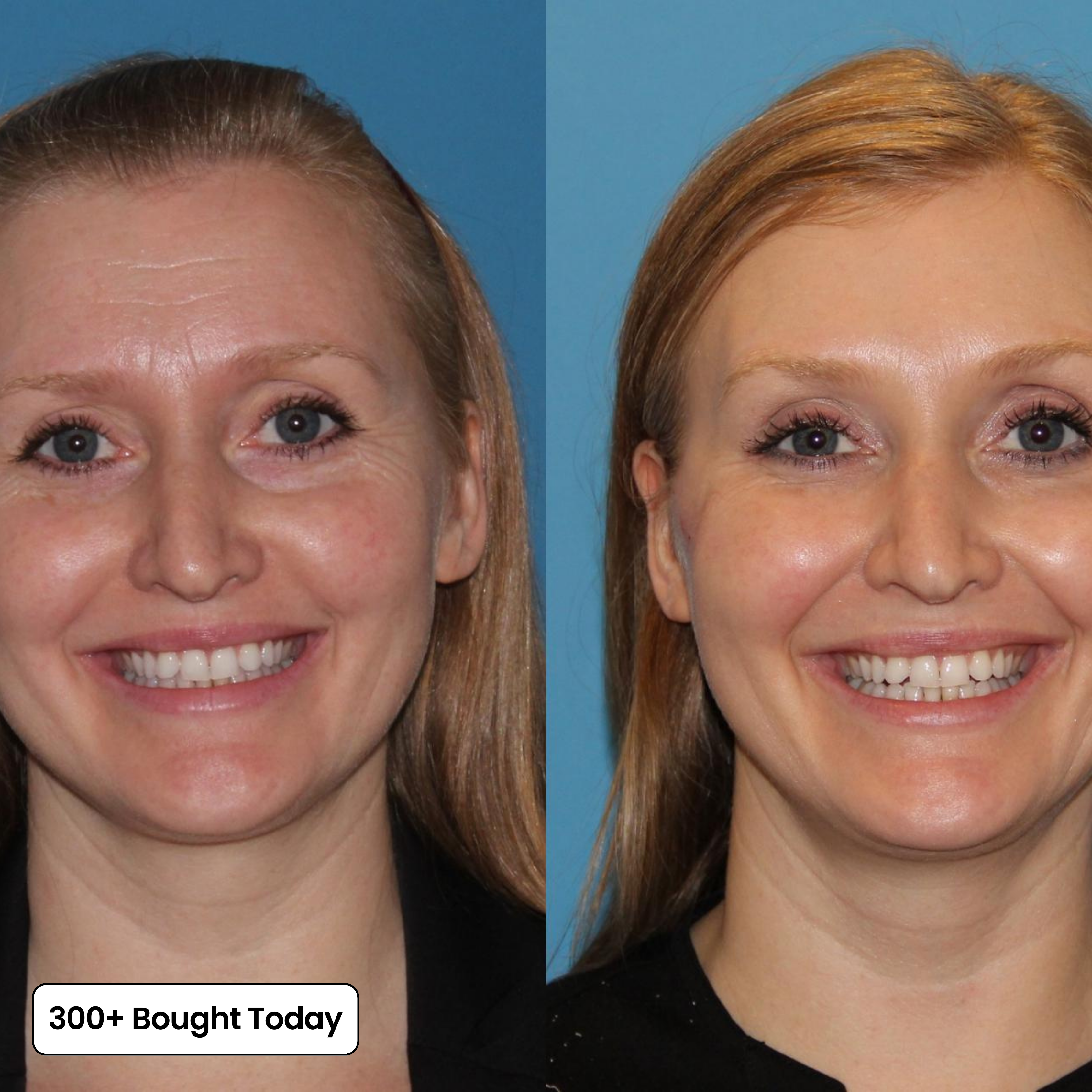 Skin Revival™ Honey Balm