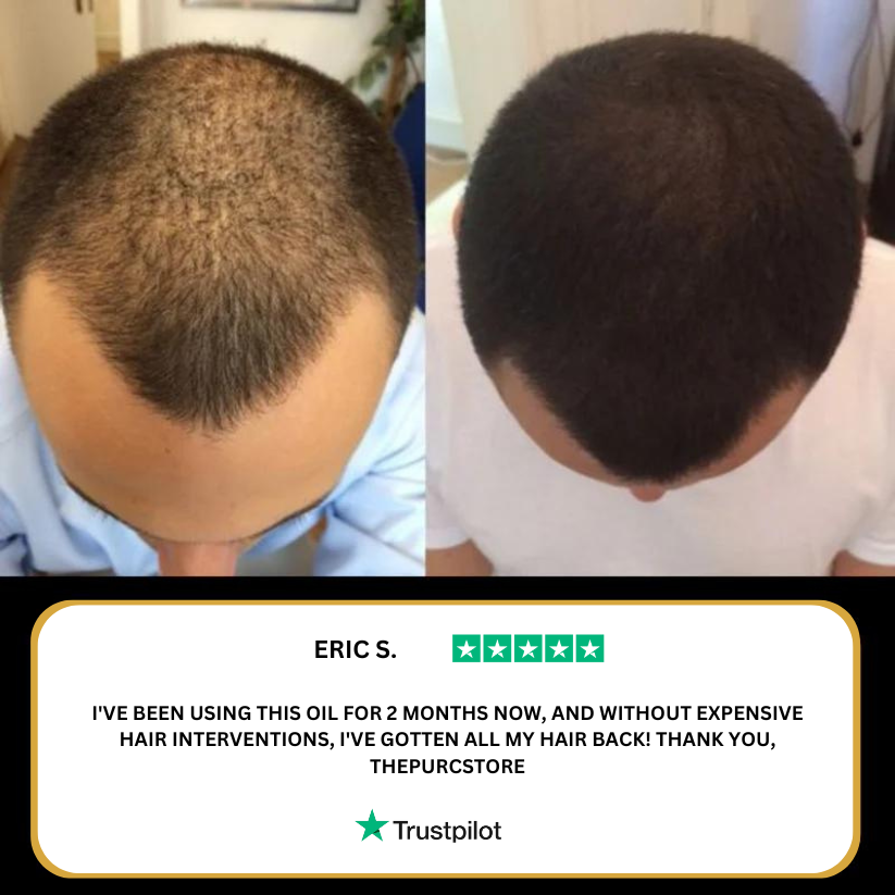PURE™ Natural Hair Growth Oil