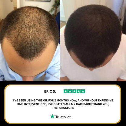 PURE™ Natural Hair Growth Oil